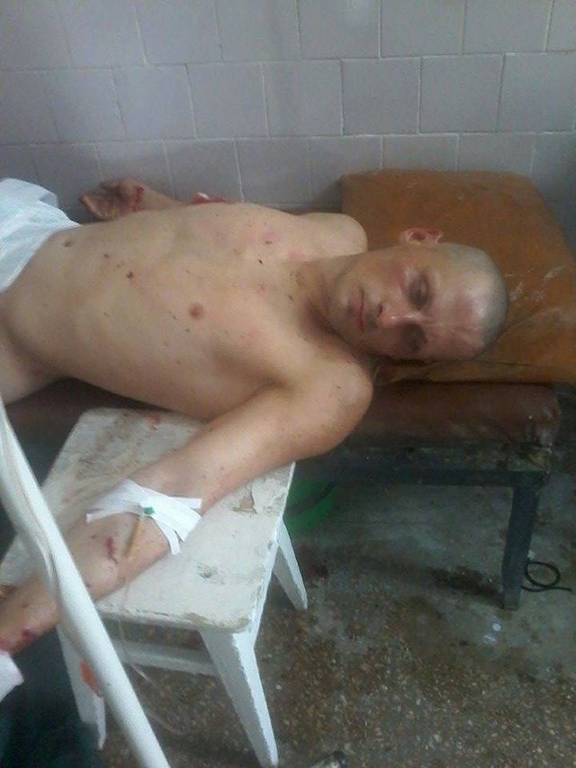 Конец карьеры террориста с позывным «Беркут». ФОТО