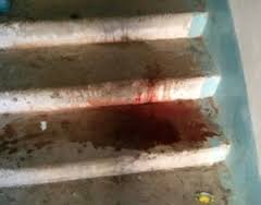 Бизнесмен, в которого стреляли в подъезде — скончался в больнице