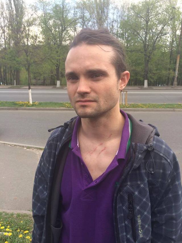 Неизвестные снова напали на журналистов возле дома замминистра МВД Чеботаря