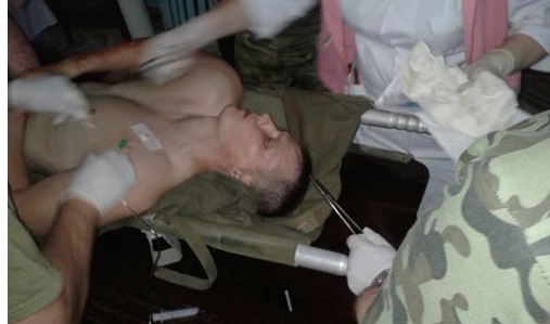 Пленный российский спецназовец потребовал оперировать его без наркоза: стерёг свои почки, – врач