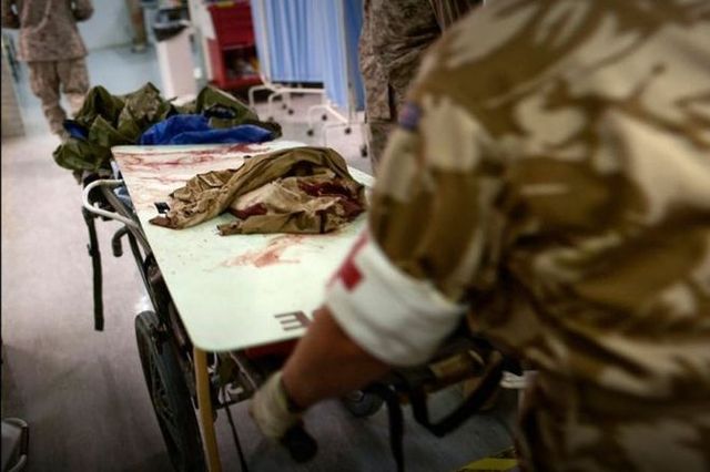 Пленного воина 28-й бригады чудовищно истязали российские наемники