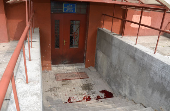 Врачи о пострадавших во Львове: женщина лишилась ноги и почки