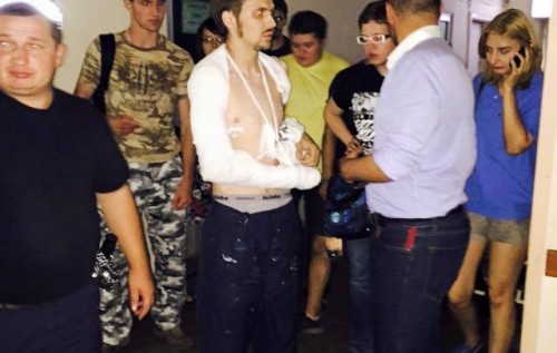 Участнику АТО сломали руку при задержании по делу взрыва под Радой. ФОТО, ВИДЕО