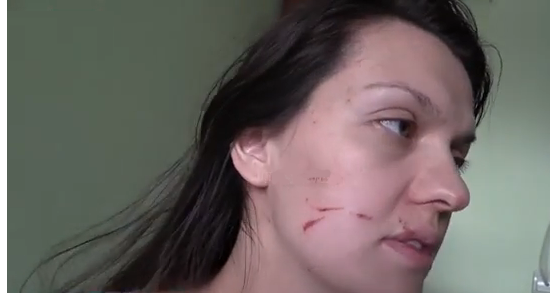 Врач элитной московской клиники избила беременную беженку с Донбасса (+видео)