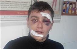 У помешканні батьків одного з підозрюваних у бійці на Драгобраті проводиться обшук