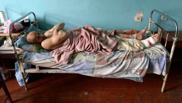 Боевиков «ДНР» массово косит туберкулез и гепатит