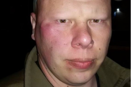 Десяток молодчиков с ножами и пистолетами избили волонтёра из команды Порошенко