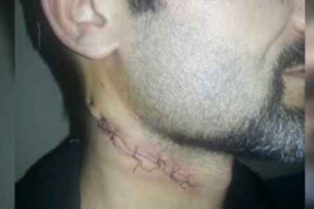 Крымский татарин перерезал себе горло в суде, отказавшись от гражданства РФ