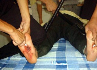 Німеччина опублікувала розслідування про тортури у в’язницях «ЛНР і ДНР»