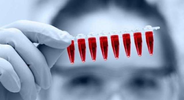 В СЭС предупредили о возможной вспышке гепатита А в Измаиле