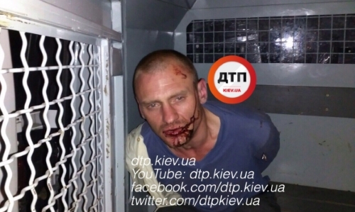 Под Киевом хозяин дома сильно избил ворвавшихся ночных грабителей