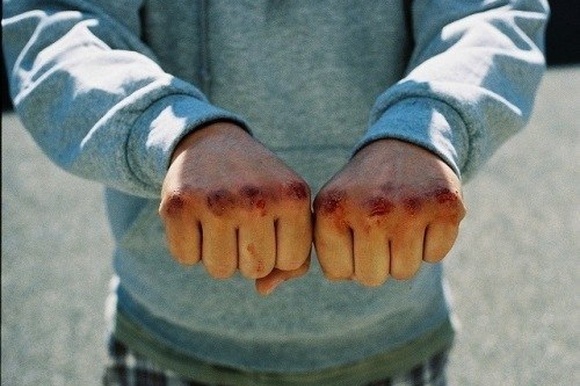 Бійкою та стріляниною закінчилася акція батальйону ОУН