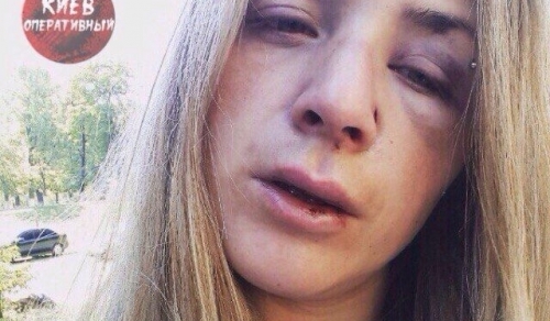 Невідомий жорстоко побив та пограбував киянку (відео)