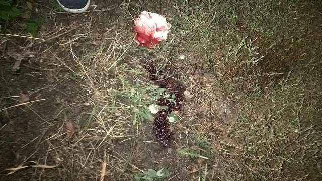 На Киевщине между подростками произошла драка со стрельбой: пострадавший в реанимации