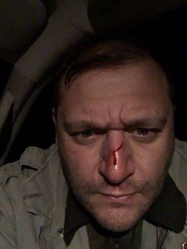 Допа получил по носу