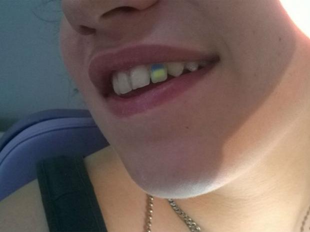 У зоні АТО запрацювало перше патріотичне стоматологічне радіо "Тризуб ФМ"