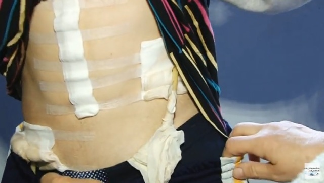 20-річний хлопець звинуватив копів у побитті під час допиту: у нього розірвана селезінка