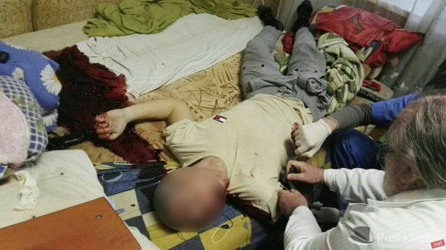 В центре Одессы мужчина выстрелил себе в голову и выжил