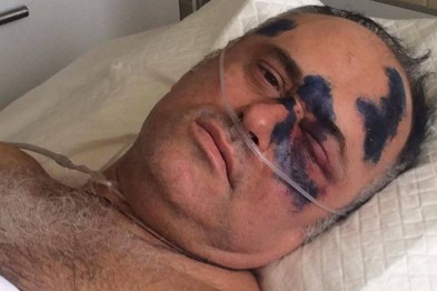 В Одессе грабители избили главу райсовета