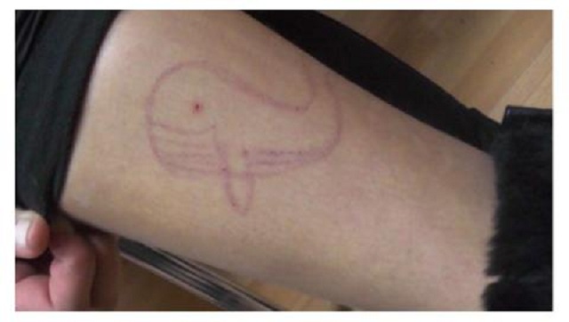 В оковах социальных "групп смерти" – тысячи украинских подростков