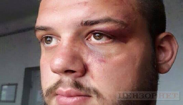 В Лукьяновском СИЗО экс-боец "Торнадо" разбил голову сокамернику