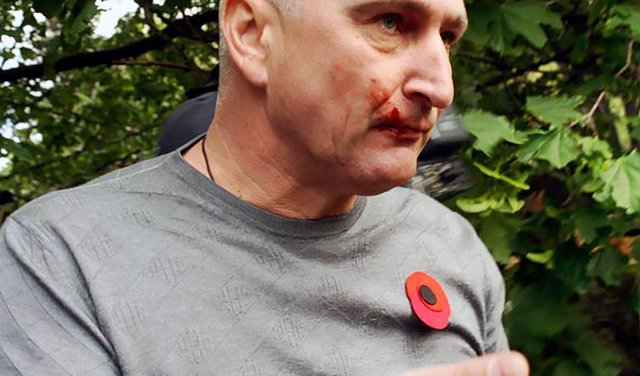 Враг поднял голову в Днепре по нашей с вами вине