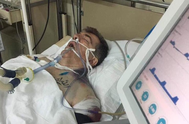 Стрелявшему в чеченского добровольца Осмаева объявлено о подозрении