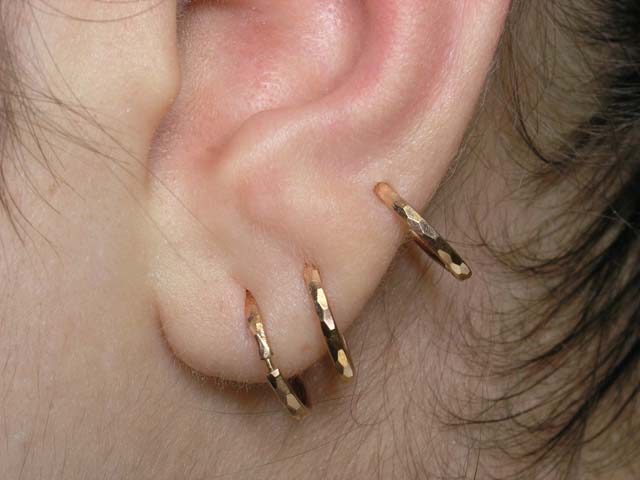 У умершей девушки украли золотые сережки в областной больнице Житомира