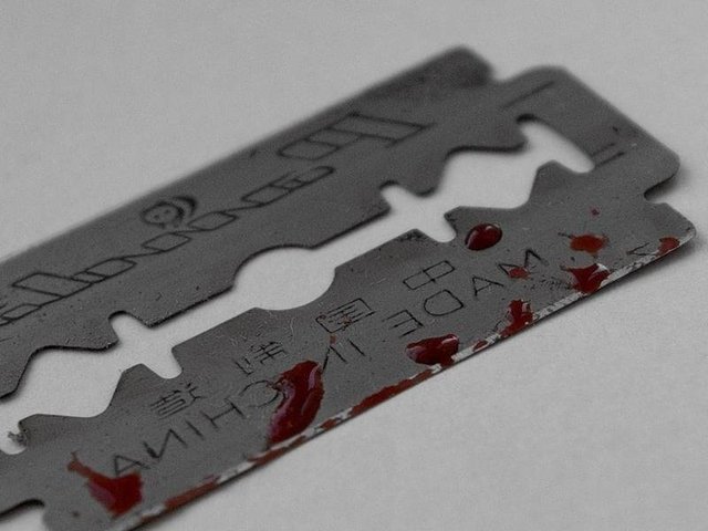 В Днипре вор, пойманный на горячем, попытался себя убить