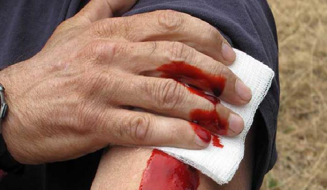 Стрельба в Мариуполе: у входа в ночной клуб тяжело ранили парня