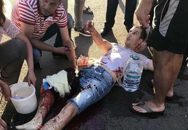 У центрі міста Коростень спалахують бандитські розбірки, на які поліція закриває очі