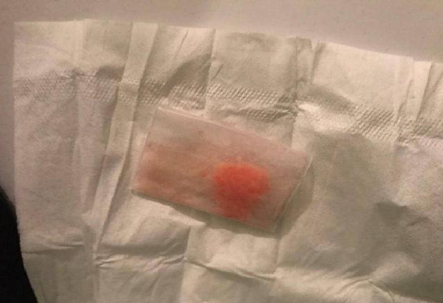 Правоохранители ликвидировали одну из крупнейших сетей борделей на Киевщине, - Нацполиция