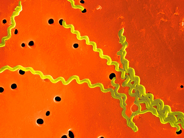 В Киеве подтвердили первую смерть от опасного инфекционного заболевания