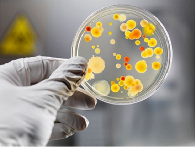 Вспышка сальмонеллеза: врач назвал самый опасный продукт