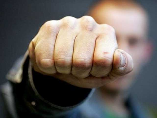 СМИ узнали имя человека, которого до полусмерти избили у дома нардепа Березы