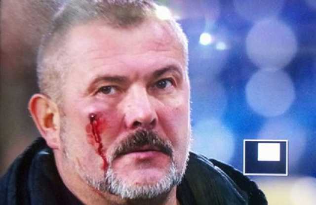 Фанаты футбольного «Днепра» избили нардепа Березу