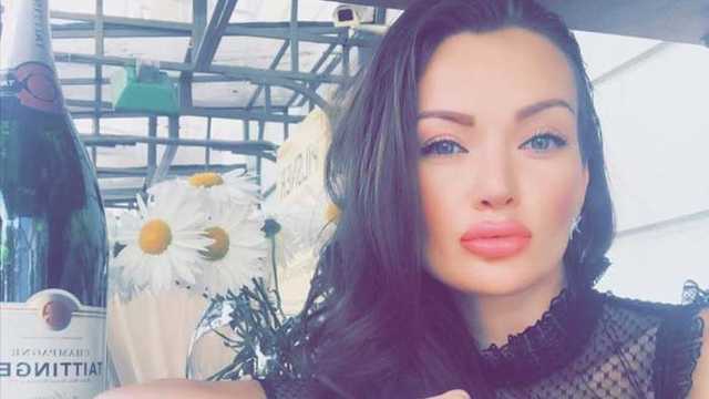 Подрыв авто в Киеве: пострадавшей модели прооперировали глаз