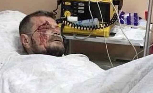 Покушение на Мосийчука: появилось фото раненого депутата