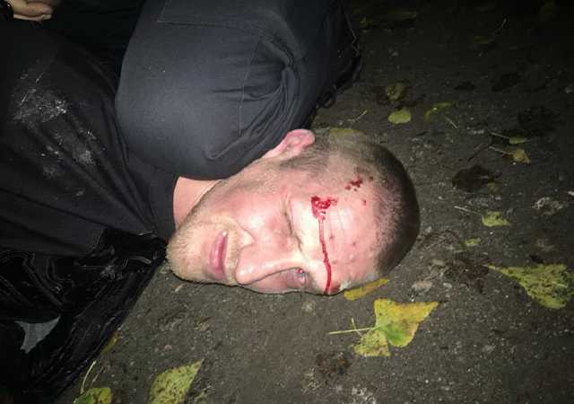 Патрульный Кропивницкого был ранен во время задержания грабителей