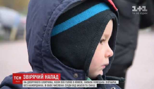 Жінка з дитиною постраждали від нападу великої собаки