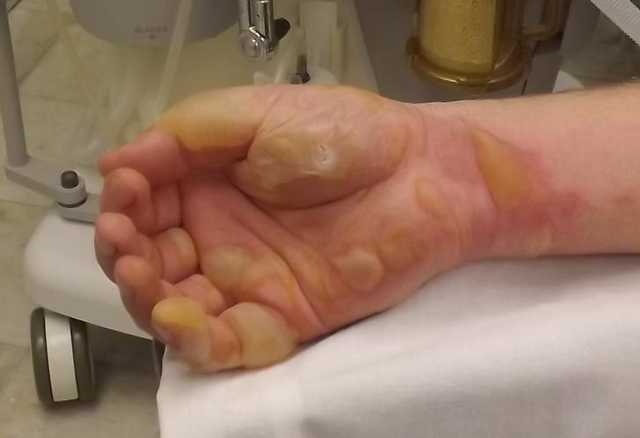 Залечили до смерти: всплыли шокирующие подробности гибели ребенка на Винниччине