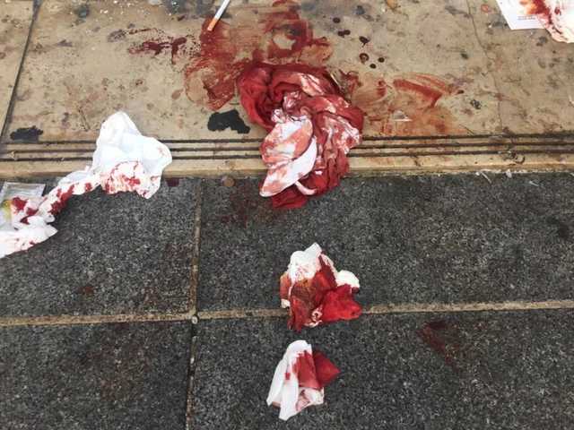 Трагедия в киевской семье: 15-летнюю девушку нашли с ножом в груди