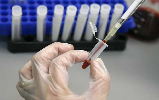 Вспышка гепатита в Харьковской области: количество больных растет