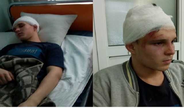 Дети-убийцы: Прокуратура Киевщины переквалифицировала дело об избиении подростка на "разбой"