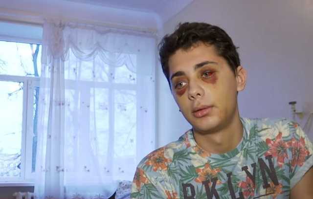 Скандальный ночной клуб в Сумах. Полиция расследует несколько дел об избиении клиентов