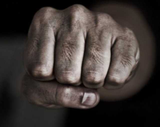 У Жовтих Водах орендатор жорстоко побив власника житла