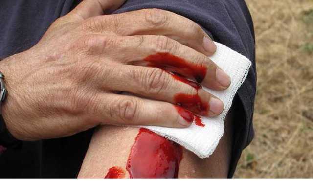 В центре Киева произошла перестрелка: есть раненые