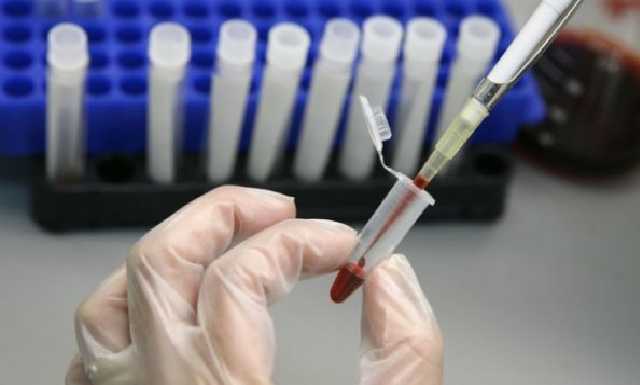 В Харьковской области с гепатитом А госпитализирован 41 житель. Люди заразились водой