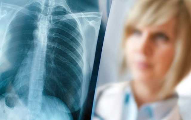 В центре столицы можно будет бесплатно проверить легкие