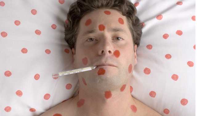 Военная прокуратура назвала источник вспышки кори среди военнослужащих на Киевщине